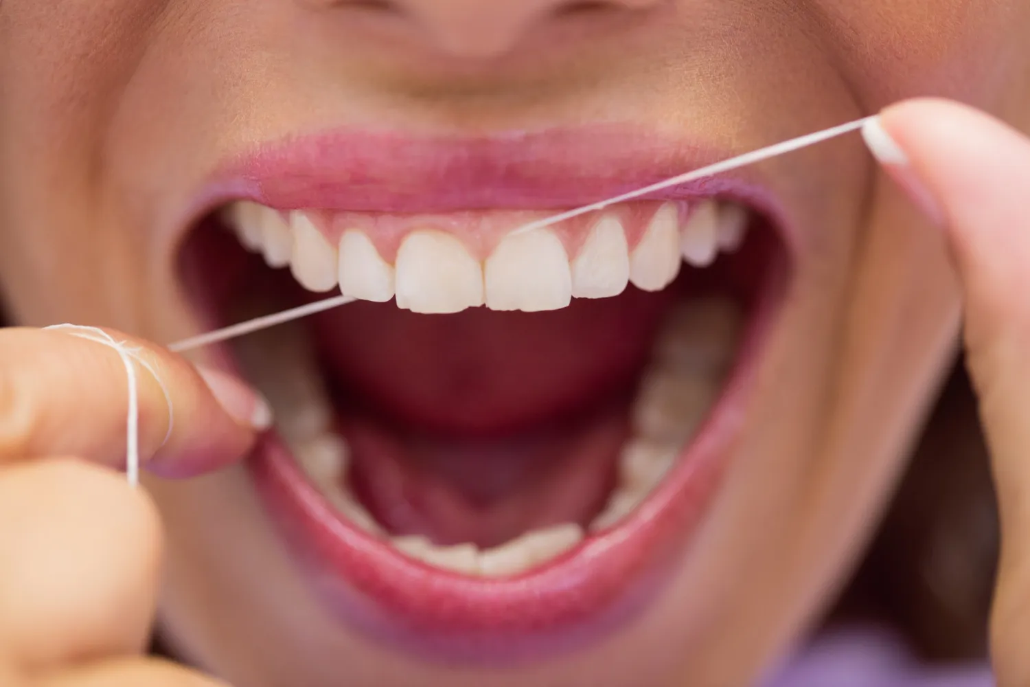Langkah Aman Cara Flossing Gigi Berjejal