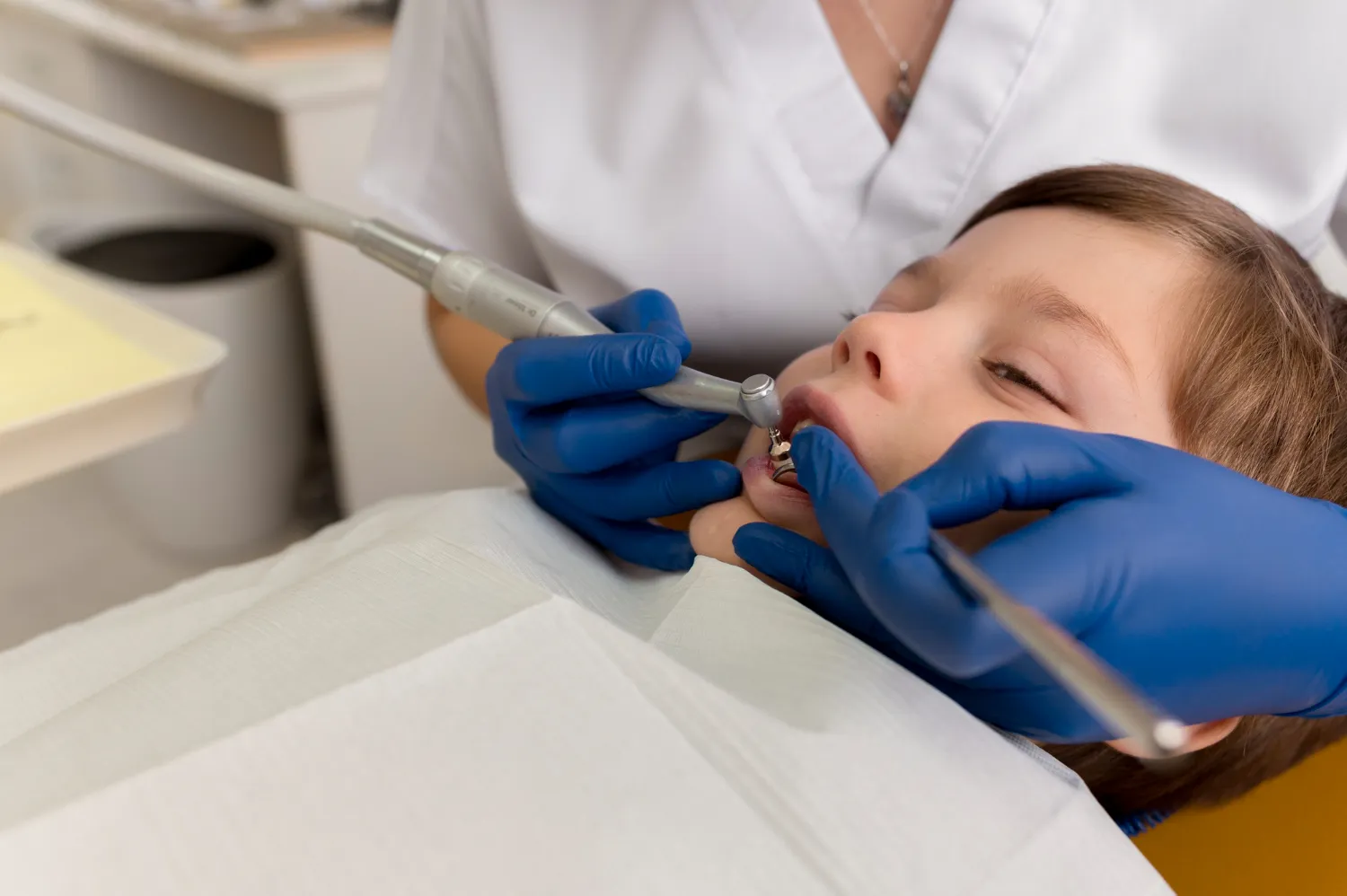 Kapan Anak Perlu Diberikan Fluoride Varnish